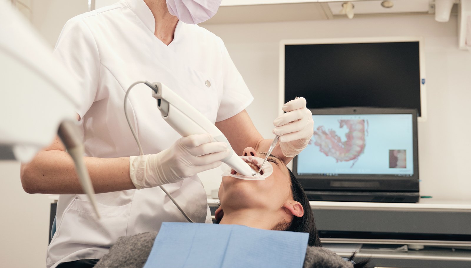 Intraoral-Camera